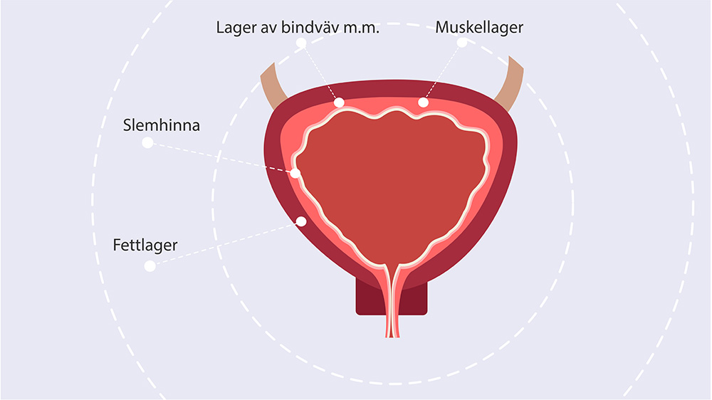 Genomskärning av en urinblåsa som illustrerar blåsväggens olika lager: slemhinna, lager av bindväv, muskellager och fettlager.